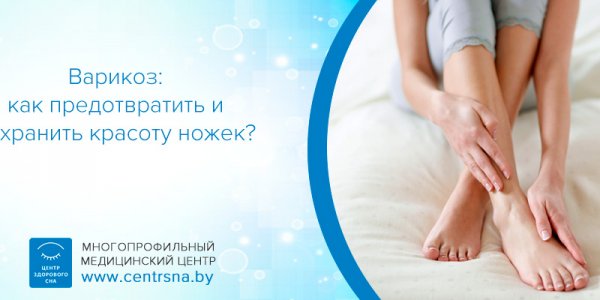 Варикоз: причины, диагностика, лечение и профилактика в Минске